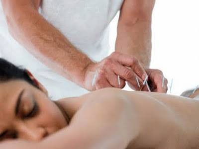 Dry Needling (Agulhamento a Seco)